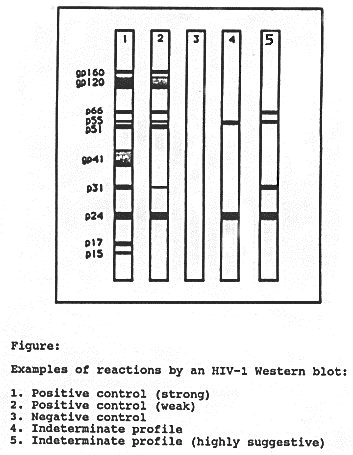 western blot